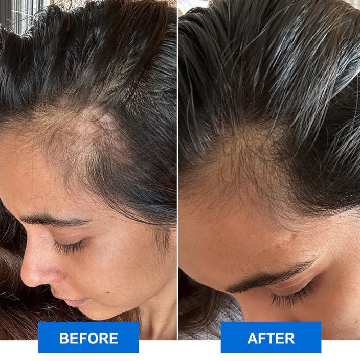 Vlife Scalp Revitalizer