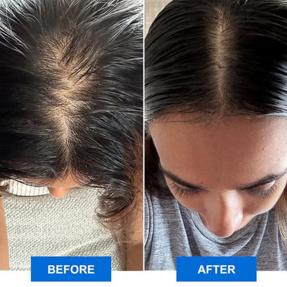 Vlife Scalp Revitalizer